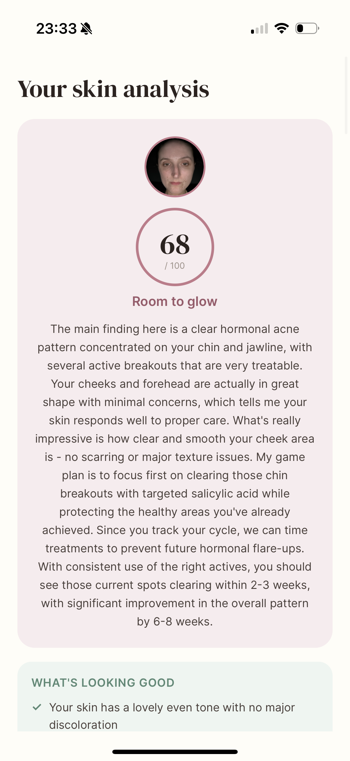 Skin analysis results screen